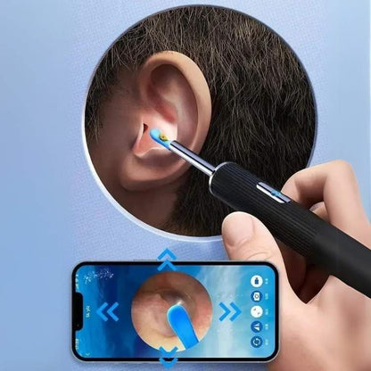 Kit de Remoção de Cera EarScope Pro - Kit de Remoção de Cera do Ouvido - Vessa