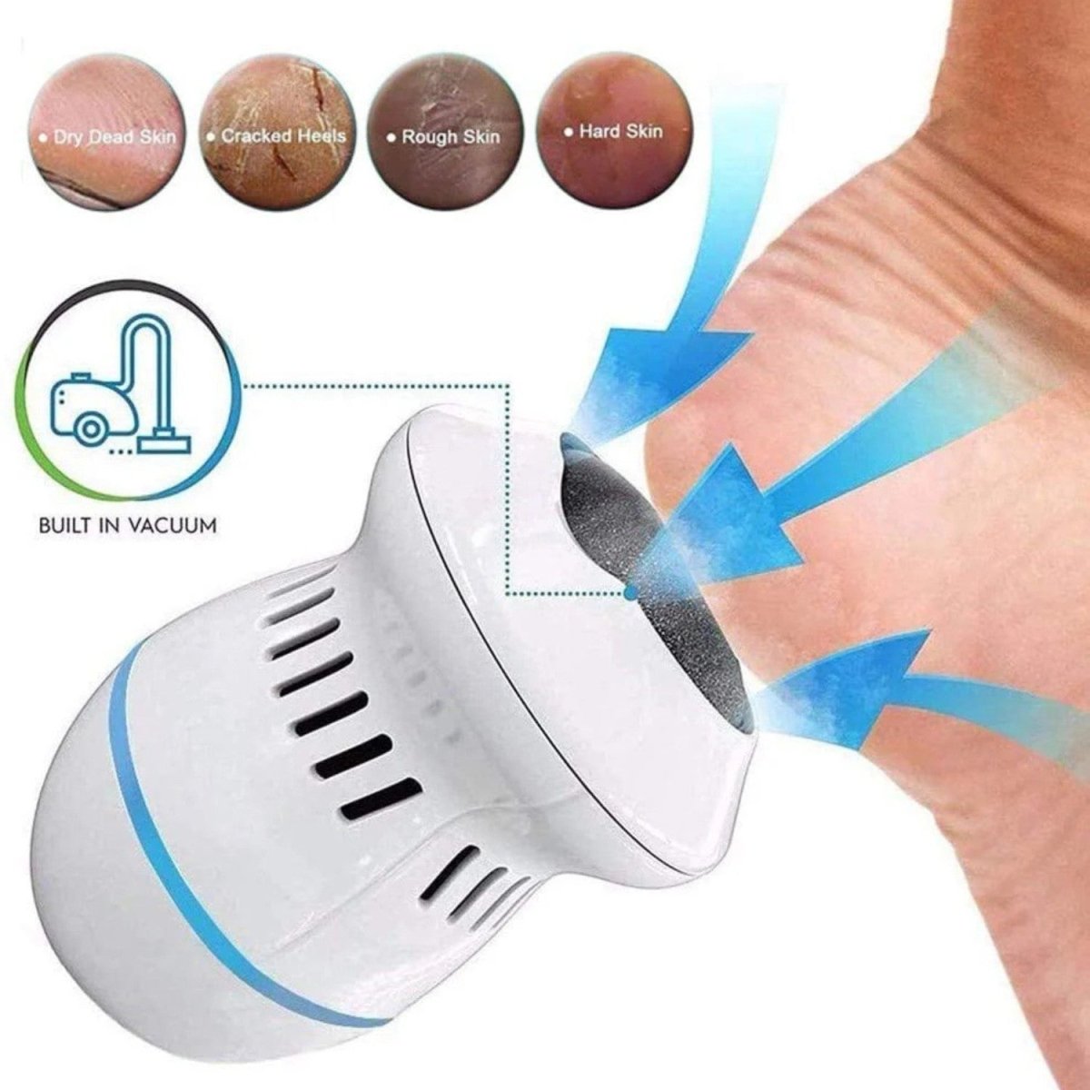 Lixadeira Elétrica de Pés para Pés Macios - Lixadeira Elétrica de Pés - Vessa